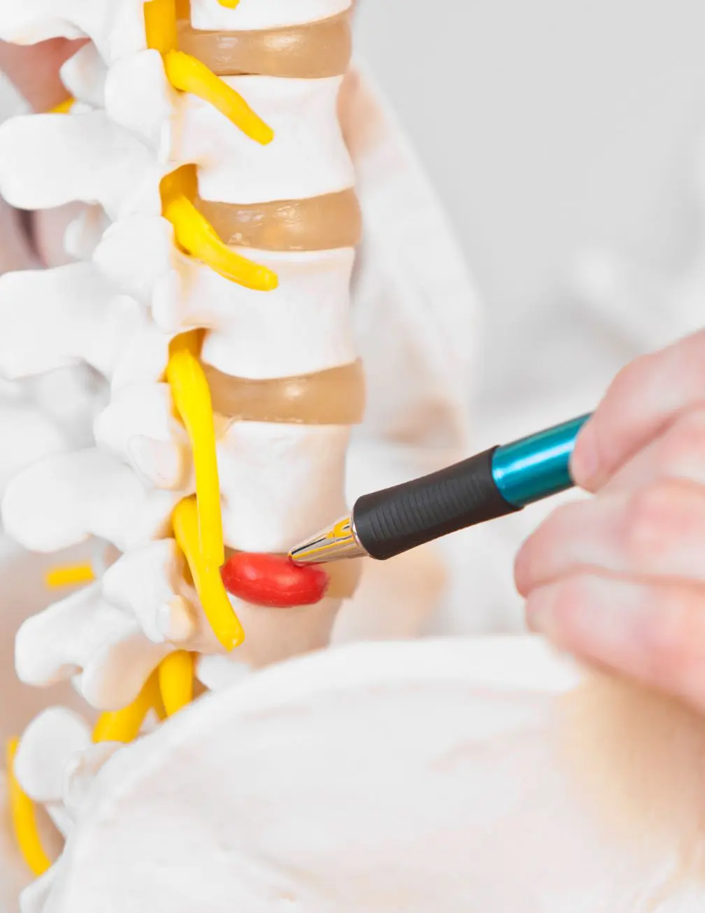 Lumbar Laminectomy Adelaide Lumbar Laminectomy Adelaide