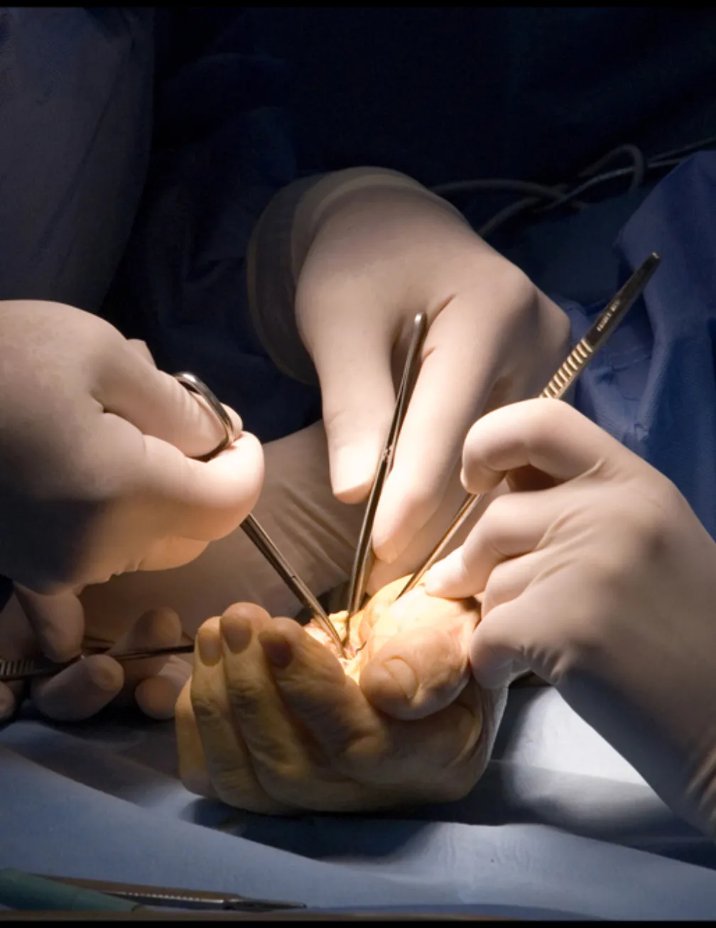 Carpal Tunnel Surgery Adelaide Carpal Tunnel Surgery Adelaide
